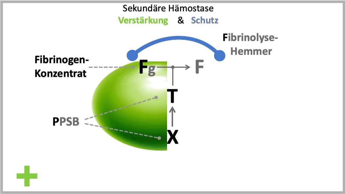 FTX - Konzept
