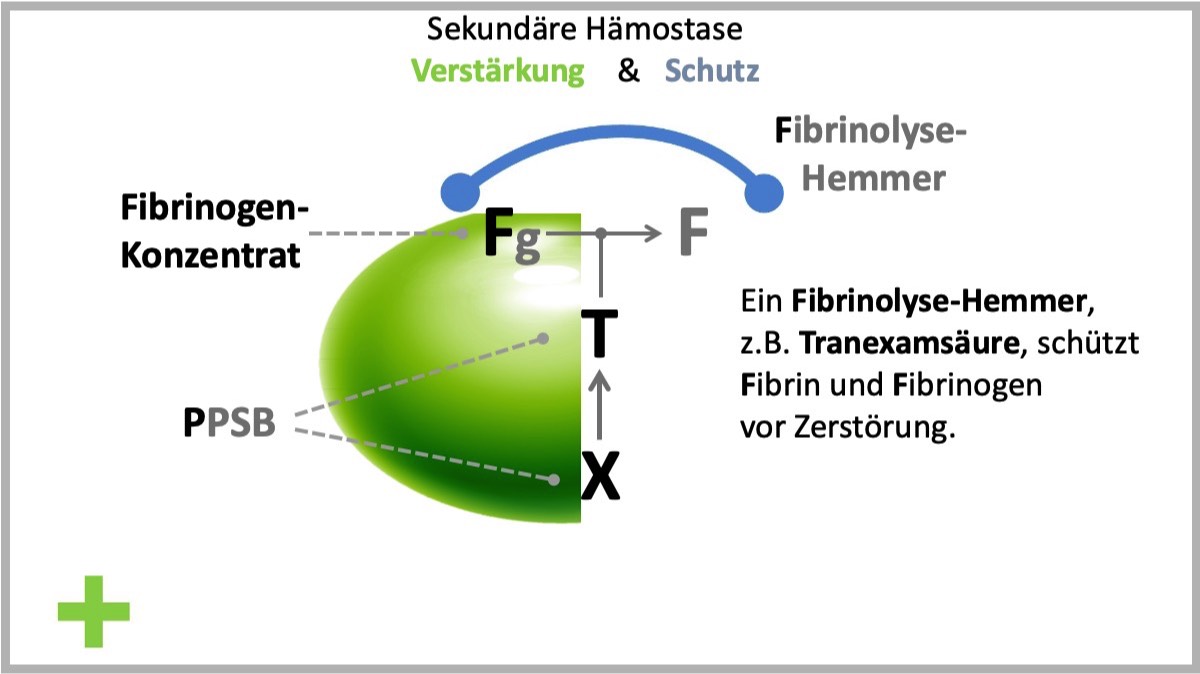FTX - Konzept