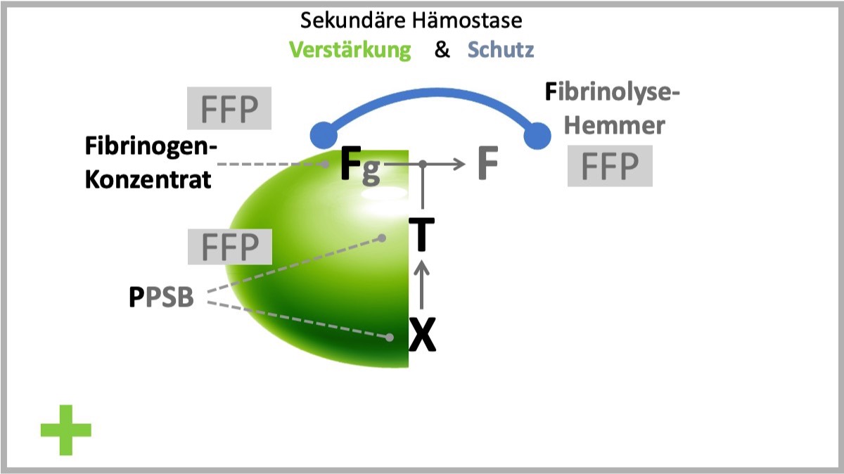 FTX - Konzept