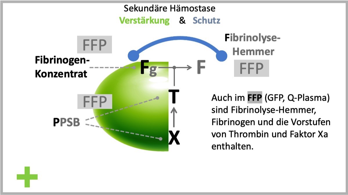 FTX - Konzept